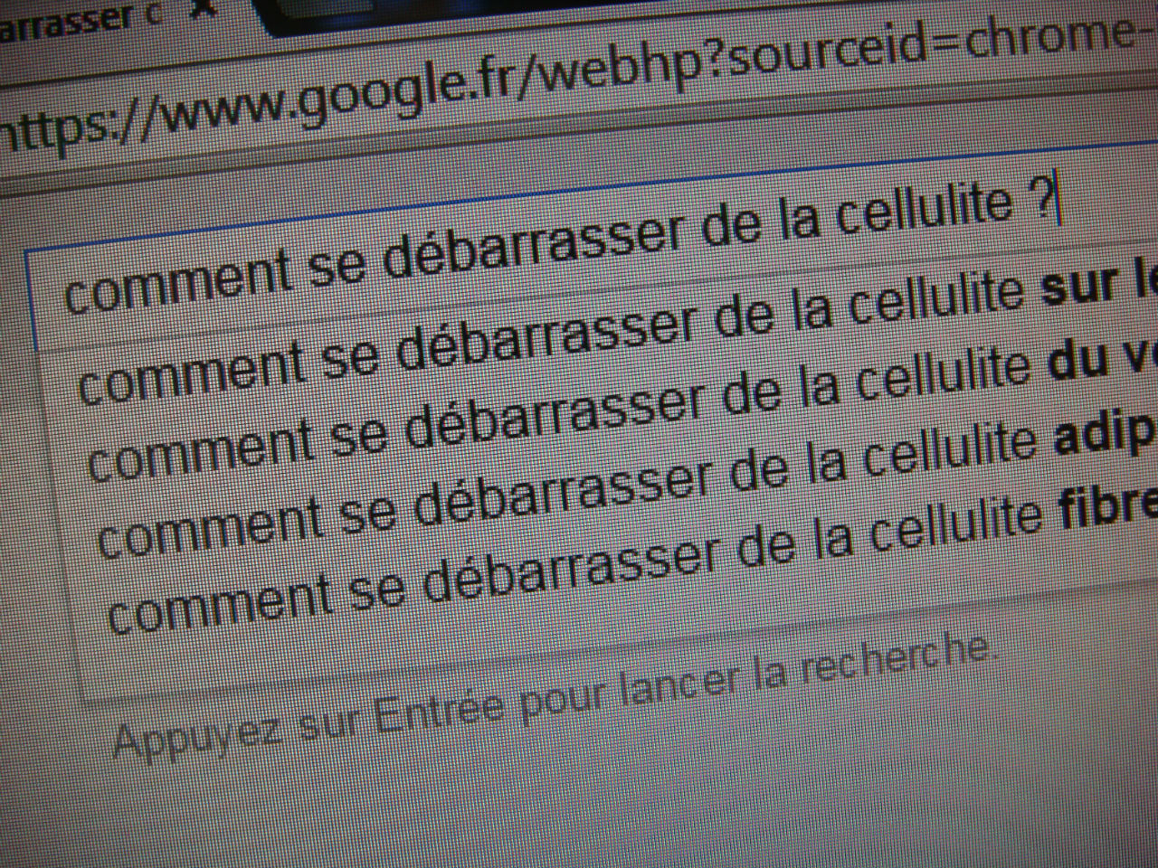 Cellulite : Comment en venir à bout ?