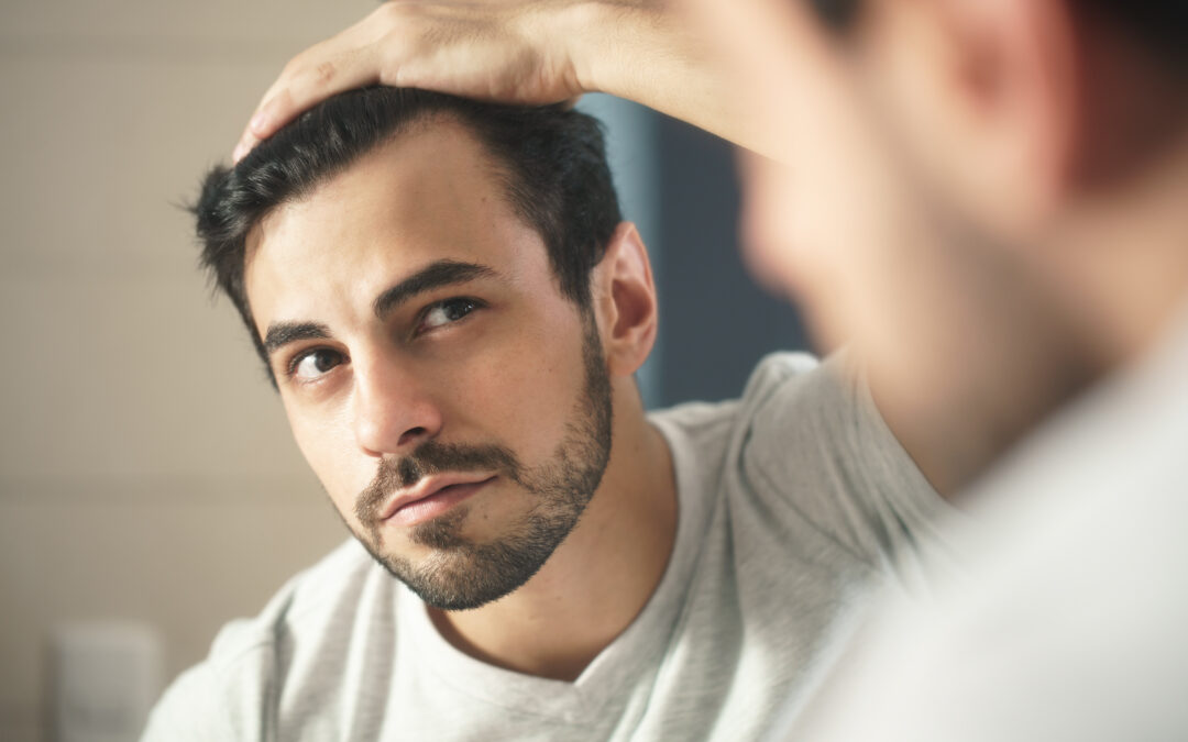 Man Worried For Alopecia Checking Hair For Loss