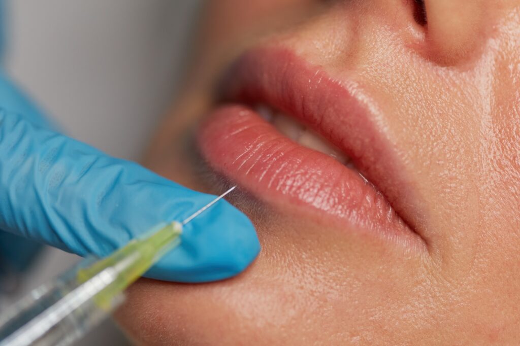 aiguille injection esthetique